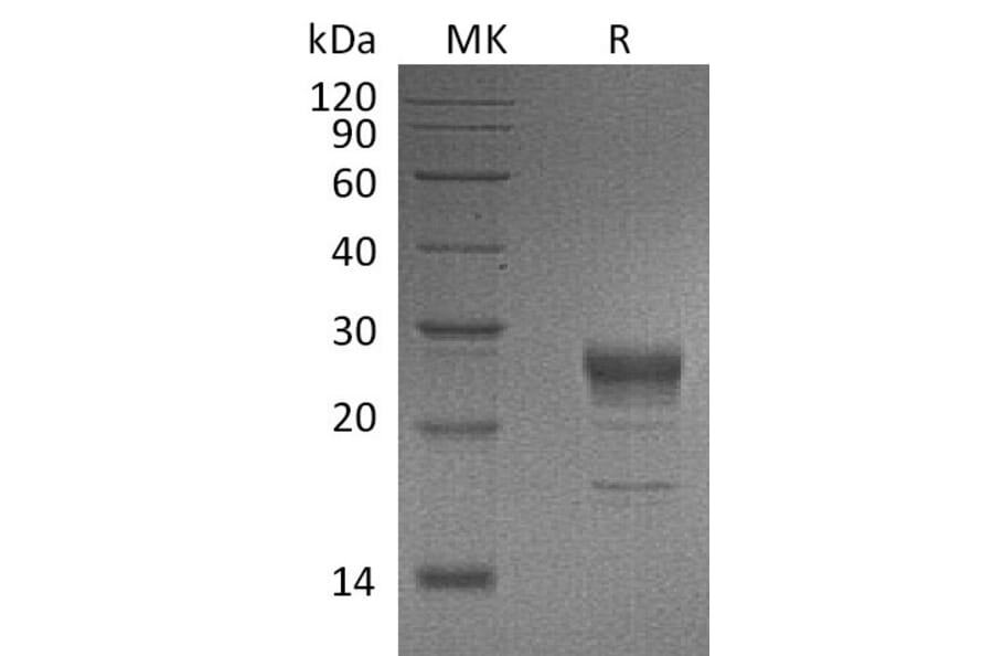 SDS-PAGE - Recombinant Human KGF/FGF-7 Protein (6×His Tag) (A317617) - Antibodies.com