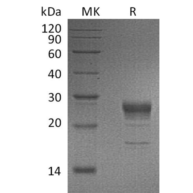 SDS-PAGE - Recombinant Human KGF/FGF-7 Protein (6×His Tag) (A317617) - Antibodies.com