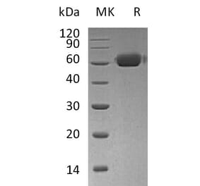 SDS-PAGE - Recombinant Human Osteoprotegerin Protein (Fc Tag) (A317618) - Antibodies.com