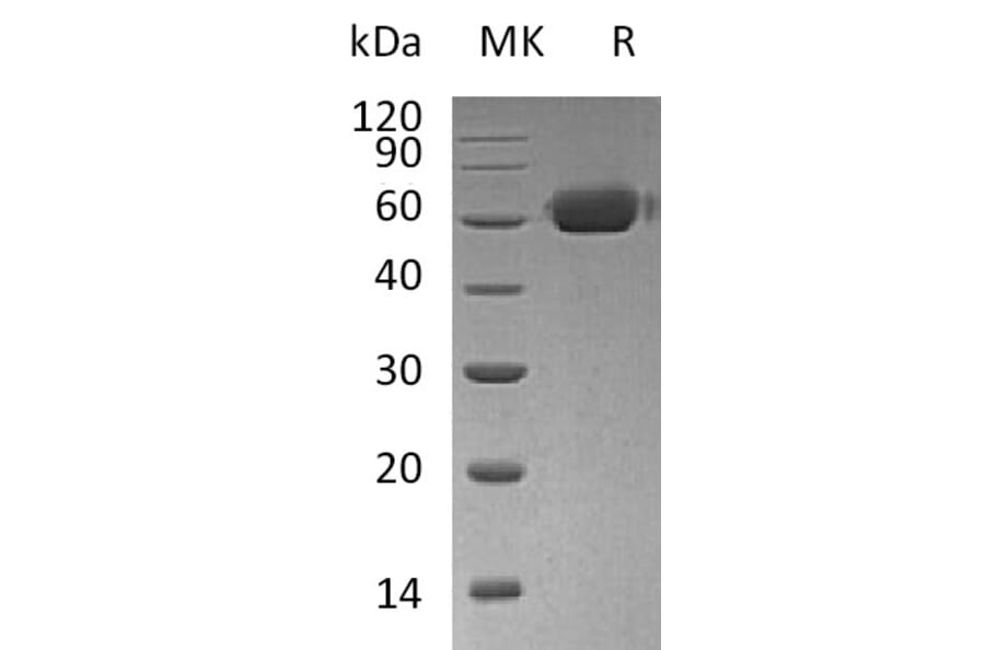 SDS-PAGE - Recombinant Human Osteoprotegerin Protein (Fc Tag) (A317618) - Antibodies.com