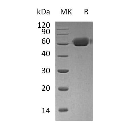 SDS-PAGE - Recombinant Human Osteoprotegerin Protein (Fc Tag) (A317618) - Antibodies.com