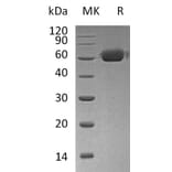 SDS-PAGE - Recombinant Human Osteoprotegerin Protein (Fc Tag) (A317618) - Antibodies.com