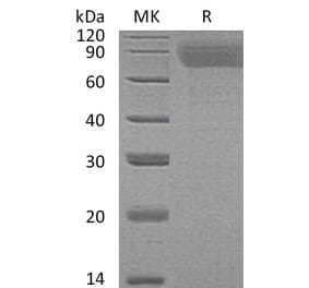 SDS-PAGE - Recombinant Human Thrombopoietin Protein (6×His Tag) (A317619) - Antibodies.com
