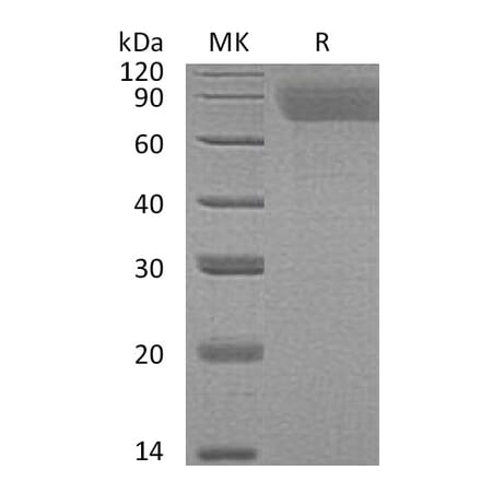 SDS-PAGE - Recombinant Human Thrombopoietin Protein (6×His Tag) (A317619) - Antibodies.com
