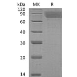 SDS-PAGE - Recombinant Human Thrombopoietin Protein (6×His Tag) (A317619) - Antibodies.com