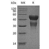 SDS-PAGE - Recombinant Human IL-12 Protein (A317620) - Antibodies.com