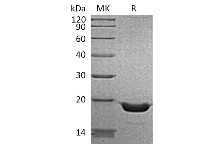 SDS-PAGE - Recombinant Human TNF alpha Protein (6×His Tag) (A317623) - Antibodies.com