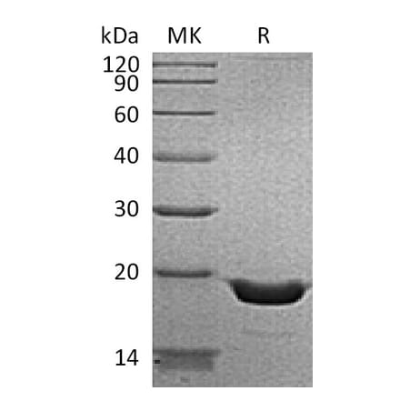 SDS-PAGE - Recombinant Human TNF alpha Protein (6×His Tag) (A317623) - Antibodies.com