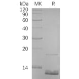 SDS-PAGE - Recombinant Human CCL18 Protein (6×His Tag) (A317624) - Antibodies.com