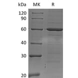 SDS-PAGE - Recombinant Human IRF5 Protein (6×His Tag) (A317625) - Antibodies.com