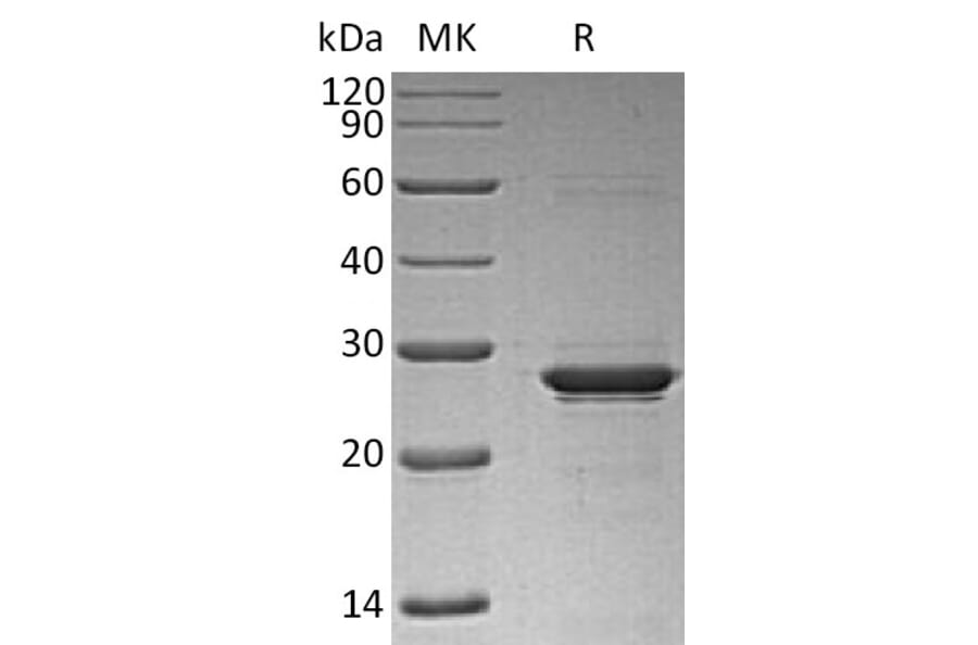 SDS-PAGE - Recombinant Human Oncostatin M/OSM Protein (6×His Tag) (A317628) - Antibodies.com