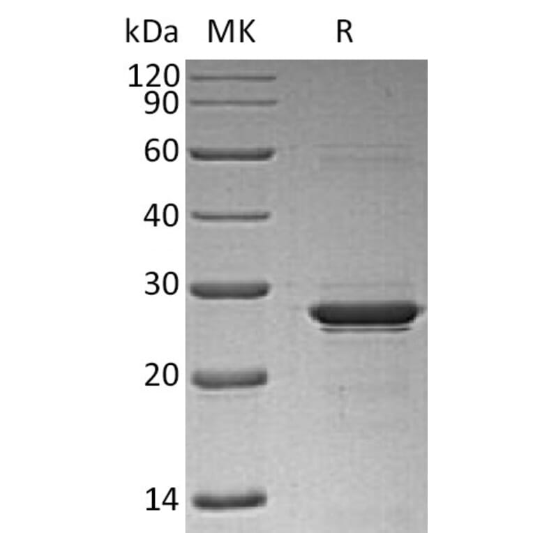 SDS-PAGE - Recombinant Human Oncostatin M/OSM Protein (6×His Tag) (A317628) - Antibodies.com