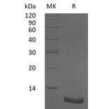 SDS-PAGE - Recombinant Human CXCL2 Protein (A317629) - Antibodies.com