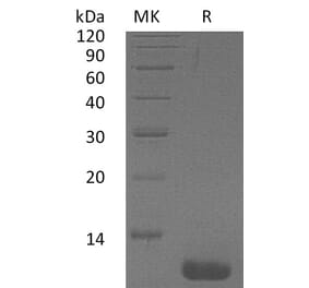 SDS-PAGE - Recombinant Human CCL1 Protein (A317630) - Antibodies.com