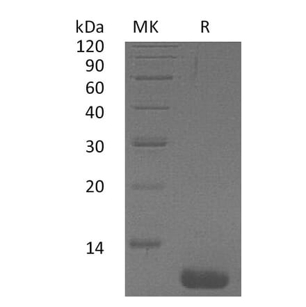 SDS-PAGE - Recombinant Human CCL1 Protein (A317630) - Antibodies.com