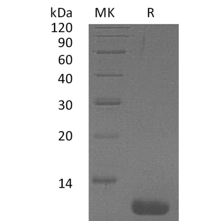 SDS-PAGE - Recombinant Human CCL1 Protein (A317630) - Antibodies.com