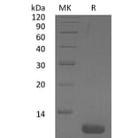 SDS-PAGE - Recombinant Human CCL1 Protein (A317630) - Antibodies.com
