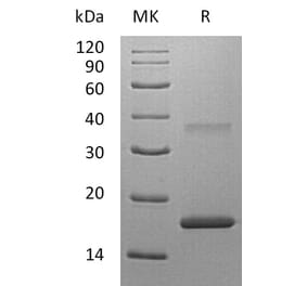 SDS-PAGE - Recombinant Human IL-7 Protein (A317631) - Antibodies.com