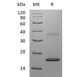 SDS-PAGE - Recombinant Human IL-7 Protein (A317631) - Antibodies.com