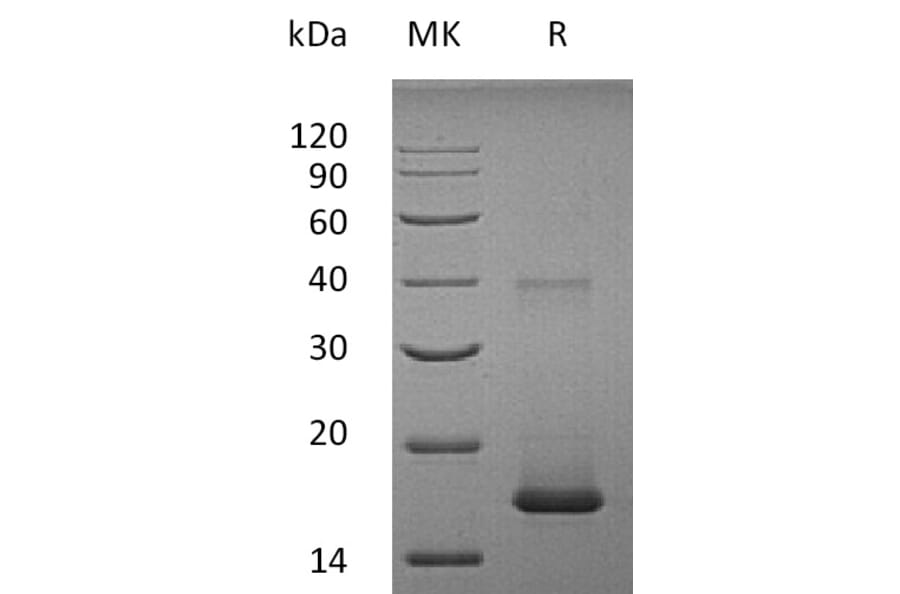 SDS-PAGE - Recombinant Human IL-1F10 Protein (A317633) - Antibodies.com