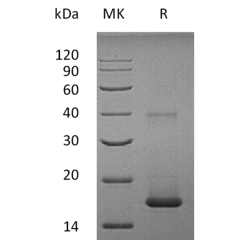 SDS-PAGE - Recombinant Human IL-1F10 Protein (A317633) - Antibodies.com