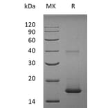 SDS-PAGE - Recombinant Human IL-1F10 Protein (A317633) - Antibodies.com