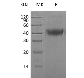 SDS-PAGE - Recombinant Human M-CSF Protein (6×His Tag) (A317634) - Antibodies.com