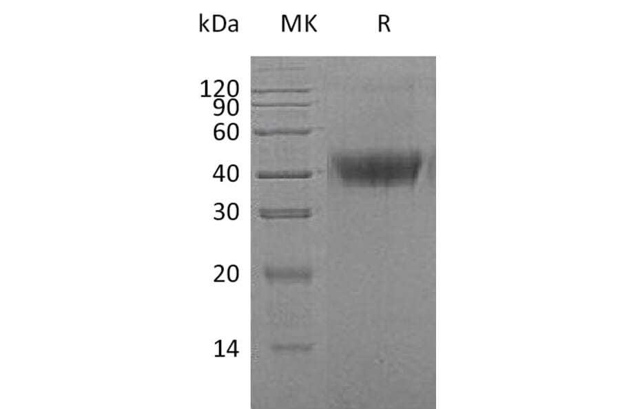 SDS-PAGE - Recombinant Human M-CSF Protein (6×His Tag) (A317634) - Antibodies.com