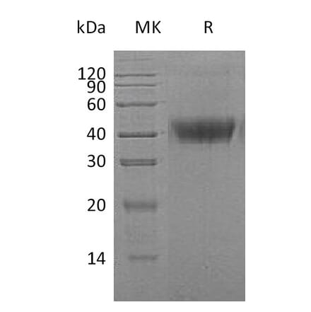 SDS-PAGE - Recombinant Human M-CSF Protein (6×His Tag) (A317634) - Antibodies.com