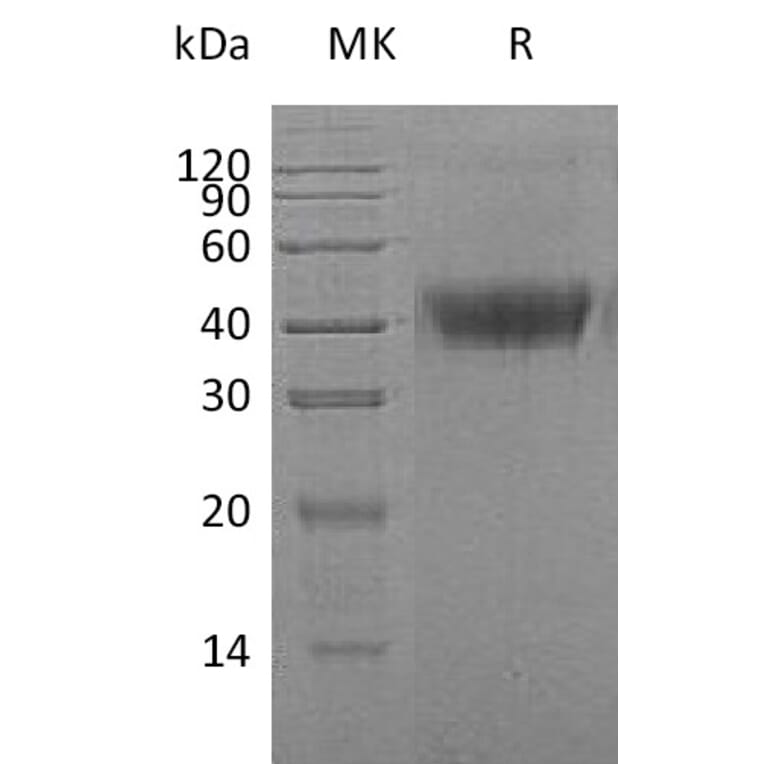 SDS-PAGE - Recombinant Human M-CSF Protein (6×His Tag) (A317634) - Antibodies.com