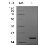 SDS-PAGE - Recombinant Human IL37 Protein (A317635) - Antibodies.com