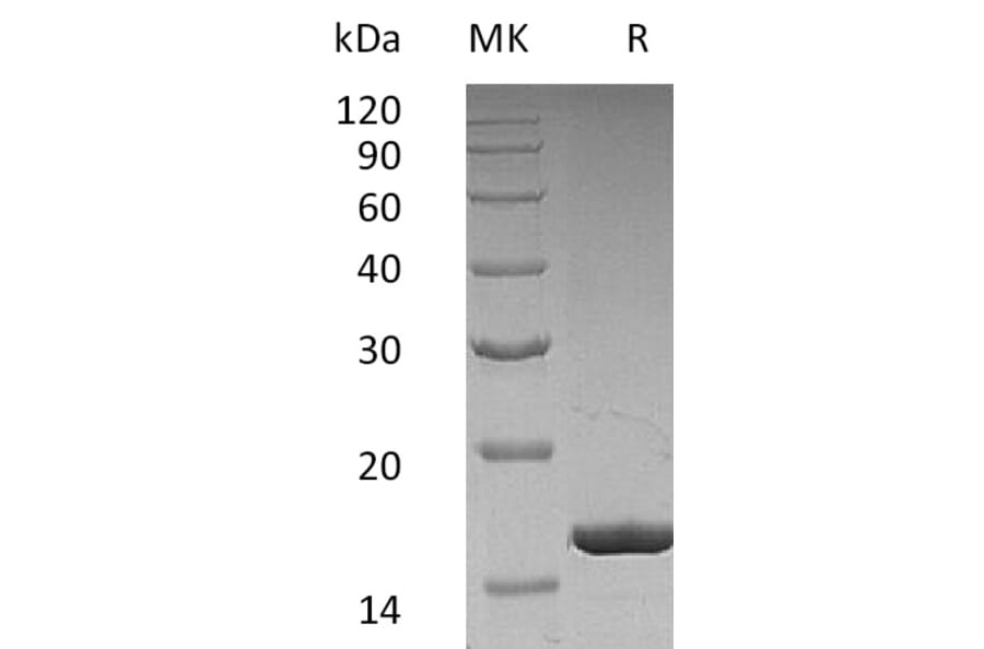 SDS-PAGE - Recombinant Human G-CSF Protein (A317639) - Antibodies.com