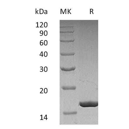 SDS-PAGE - Recombinant Human G-CSF Protein (A317639) - Antibodies.com