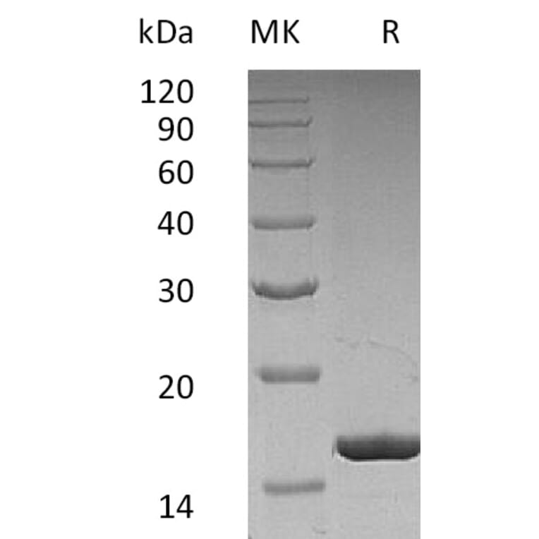 SDS-PAGE - Recombinant Human G-CSF Protein (A317639) - Antibodies.com