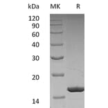 SDS-PAGE - Recombinant Human G-CSF Protein (A317639) - Antibodies.com