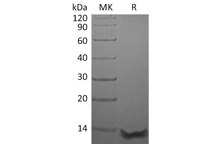 SDS-PAGE - Recombinant Human TSC-1 Protein (A317640) - Antibodies.com