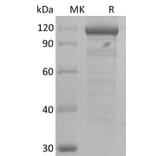 SDS-PAGE - Recombinant Human Wnt3a Protein (A317641) - Antibodies.com