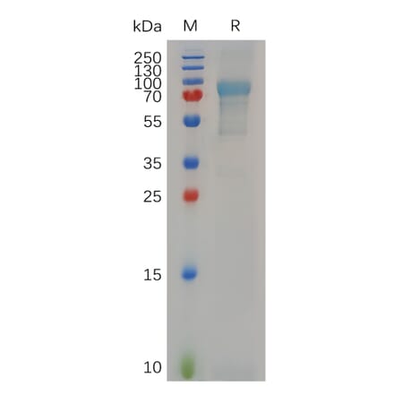 SDS-PAGE - Recombinant Human Myelin Basic Protein Protein (Fc Tag) (A317642) - Antibodies.com