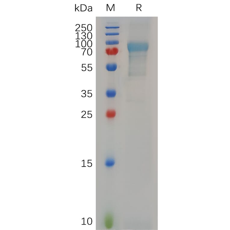 Recombinant Human Myelin Basic Protein Protein (N-terminal human Fc tag) (A317642) - Antibodies.com