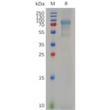 SDS-PAGE - Recombinant Human Myelin Basic Protein Protein (Fc Tag) (A317642) - Antibodies.com