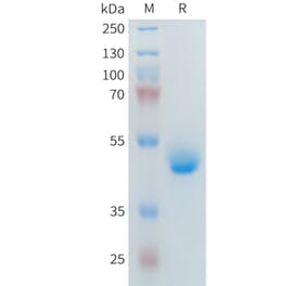 SDS-PAGE - Recombinant Human PLA2R Protein (Fc Tag) (A317643) - Antibodies.com