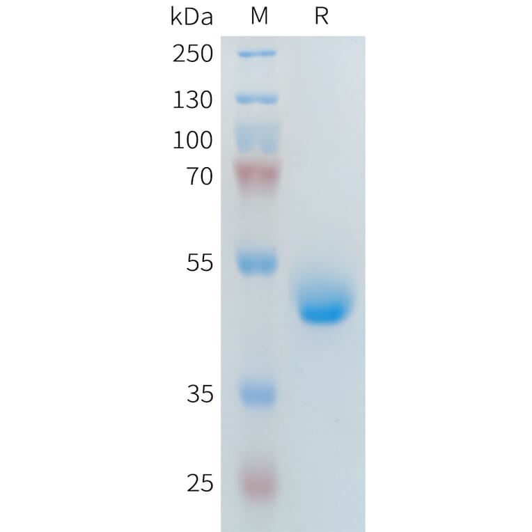 SDS-PAGE - Recombinant Human PLA2R Protein (Fc Tag) (A317643) - Antibodies.com