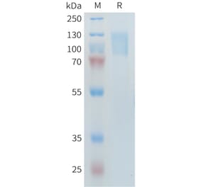 SDS-PAGE - Recombinant Human PLA2R Protein (10×His Tag) (A317644) - Antibodies.com