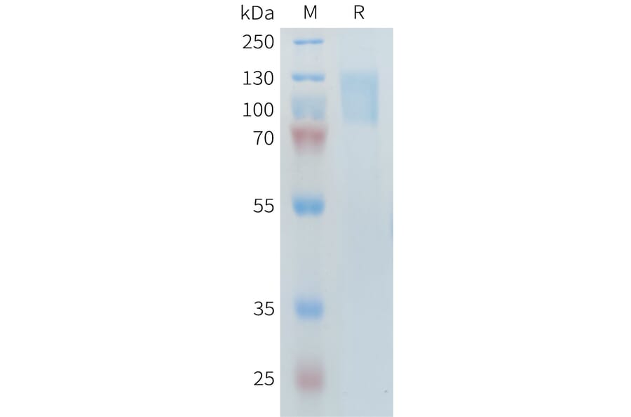 SDS-PAGE - Recombinant Human PLA2R Protein (10×His Tag) (A317644) - Antibodies.com