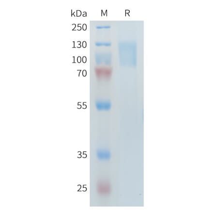 SDS-PAGE - Recombinant Human PLA2R Protein (10×His Tag) (A317644) - Antibodies.com