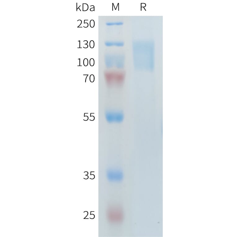 SDS-PAGE - Recombinant Human PLA2R Protein (10×His Tag) (A317644) - Antibodies.com