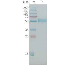 SDS-PAGE - Recombinant Human PLA2R Protein (10×His Tag) (A317645) - Antibodies.com