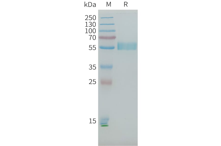 SDS-PAGE - Recombinant Human PLA2R Protein (10×His Tag) (A317645) - Antibodies.com