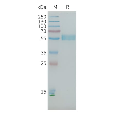 SDS-PAGE - Recombinant Human PLA2R Protein (10×His Tag) (A317645) - Antibodies.com