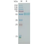 SDS-PAGE - Recombinant Human PLA2R Protein (10×His Tag) (A317645) - Antibodies.com